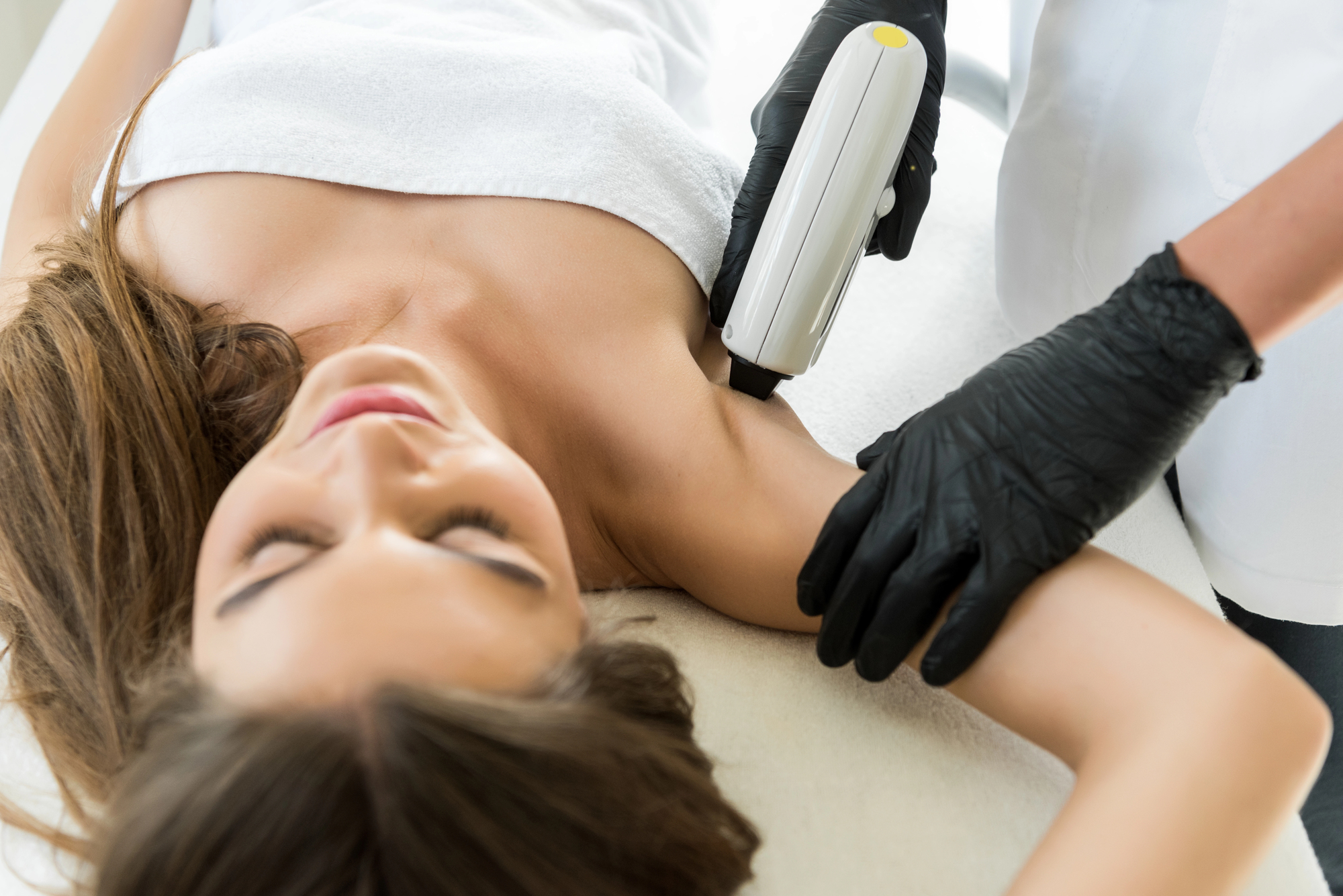 Hair Removal by Aspire